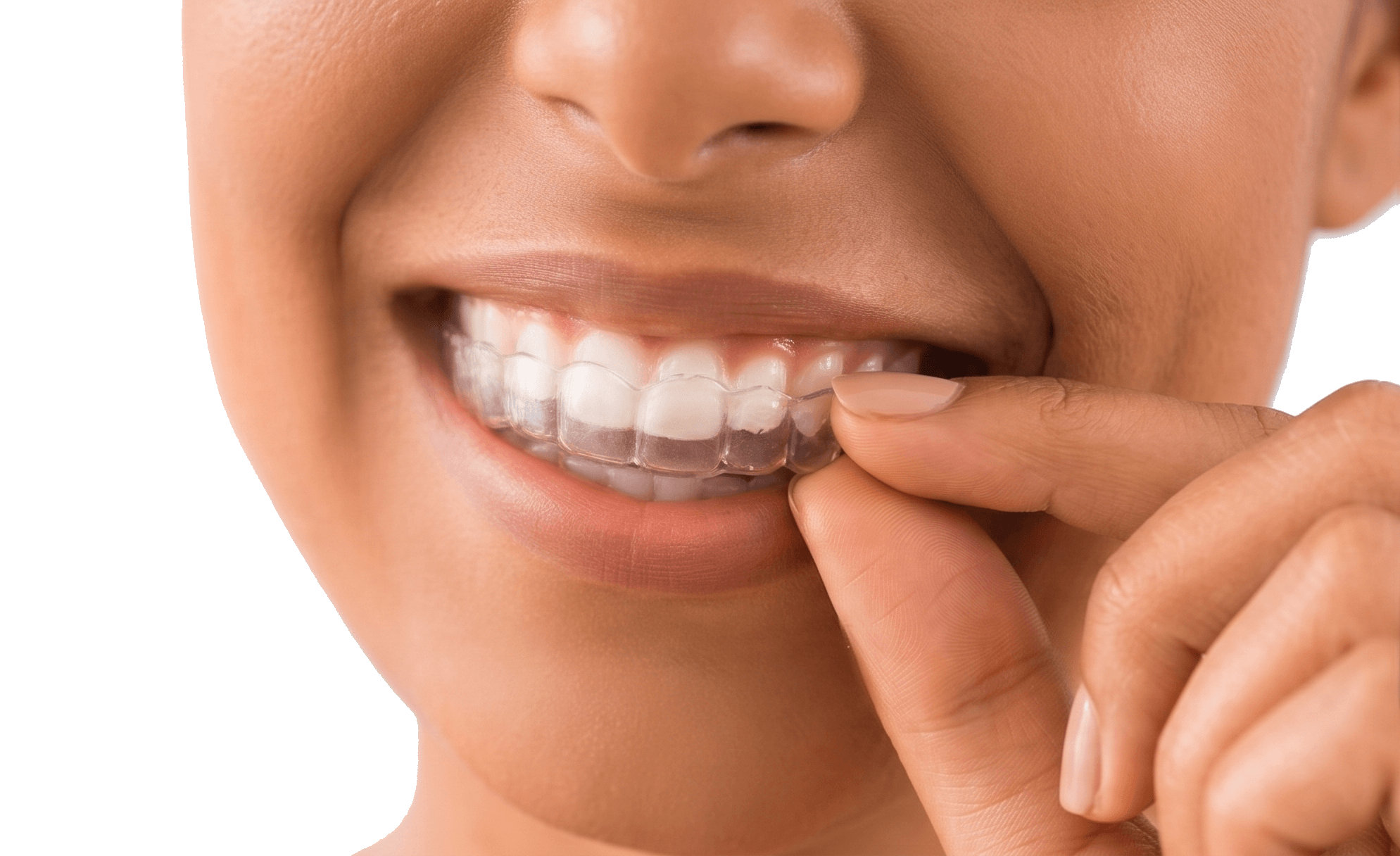 Orthodontist holding Invisalign clear aligners at Victoriapark Dental
